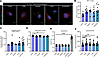 Dedifferentiating agents increase EEA1+ vesicle quantity and lysosomal acti