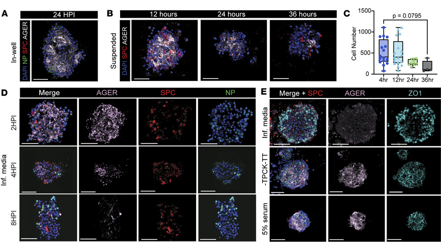 Optimization of influenza A (IAV) infection conditions for alveolar orga...