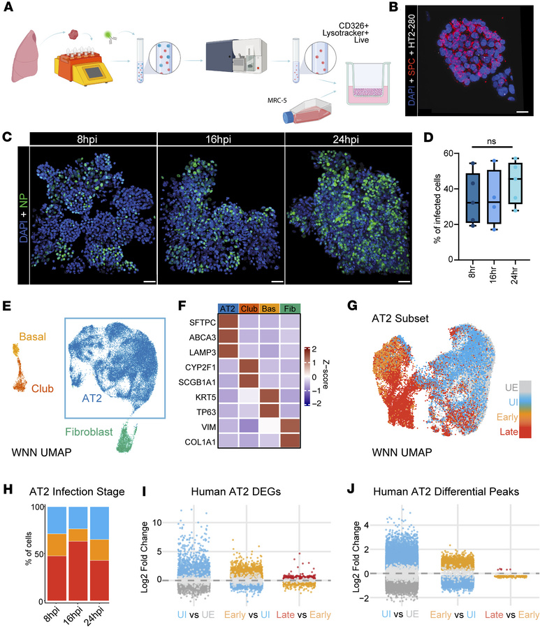 Single-nucleus analysis of flu infection in human AEOs.
(A) Schematic de...