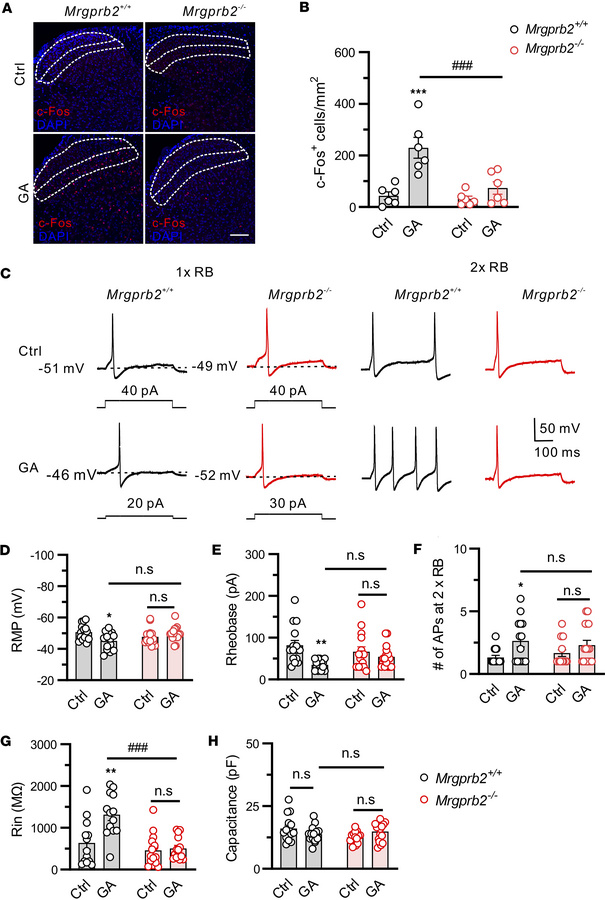 Mrgprb2 contributes to hyperexcitability of joint nociceptors following ...