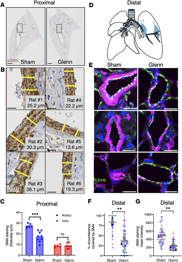 Loss of smooth muscle layer in pulmonary arteries of rats after Glenn su...