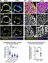 Loss of PDGFB in pulmonary endothelium and p-PDGFRβ in pulmonary vascular s