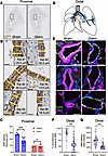 Loss of smooth muscle layer in pulmonary arteries of rats after Glenn surge