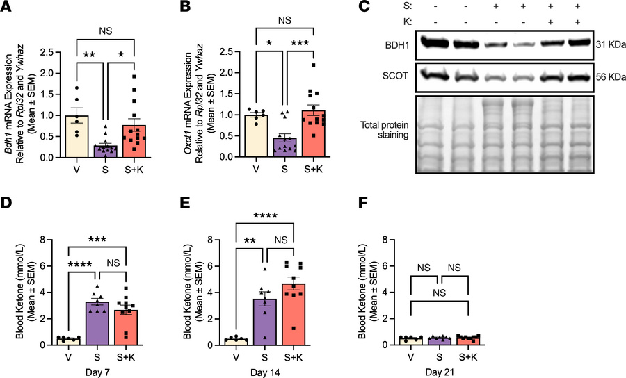 Semaglutide-induced loss of the ketolytic enzymes BDH1 and SCOT in gastr...