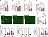 Reductions in skeletal muscle mass induced by semaglutide are blunted by ke
