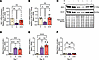 Semaglutide-induced loss of the ketolytic enzymes BDH1 and SCOT in gastrocn
