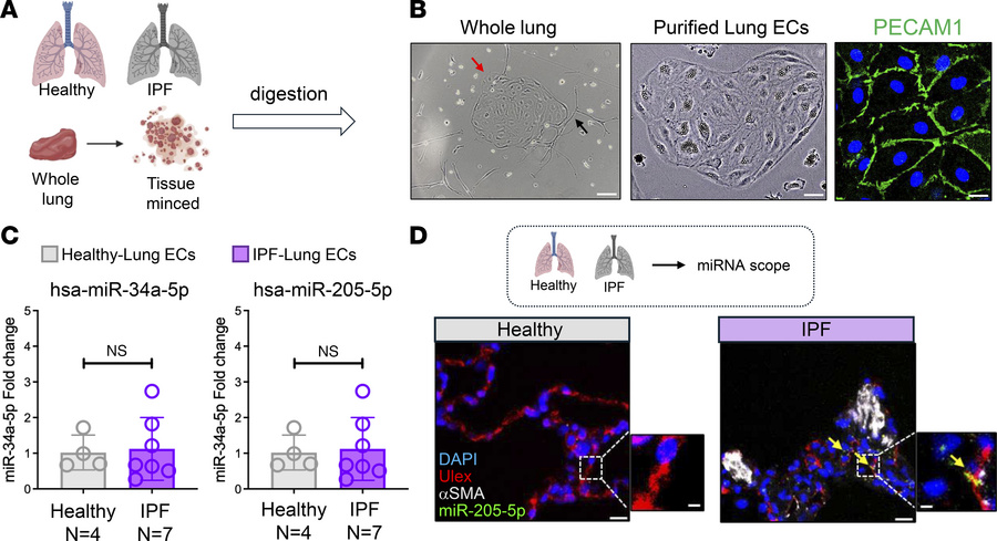 Lung endothelial miR-205-5p is overexpressed in IPF lung ECs and colocal...
