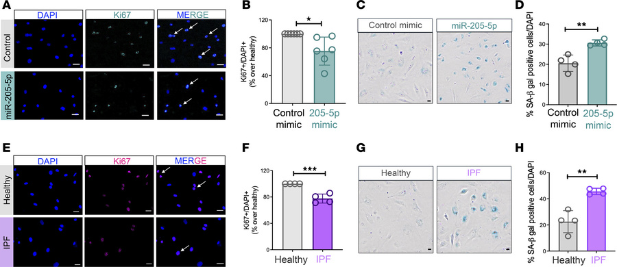 miR-205-5p induces senescence in lung ECs, mirroring cultured IPF lung E...