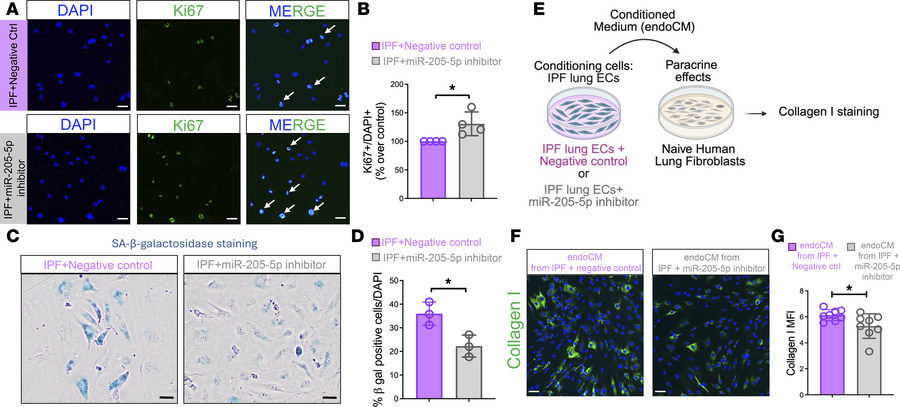 miR-205-5p inhibition attenuates IPF lung EC senescence and limits parac...