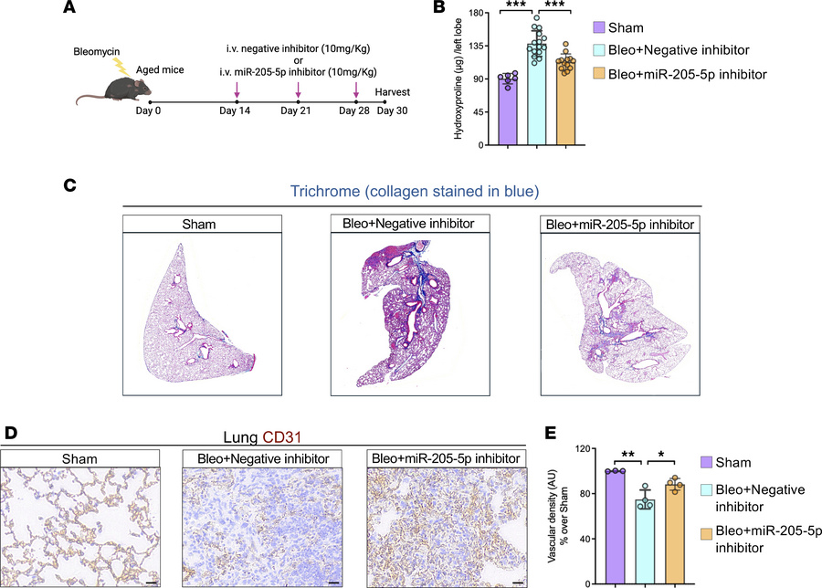 Inhibition of miR-205-5p mitigates fibrosis progression in aged mice cha...