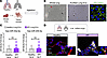 Lung endothelial miR-205-5p is overexpressed in IPF lung ECs and colocalize