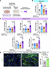 Lung endothelial miR-205-5p regulates paracrine lung fibroblast activation.
