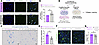 miR-205-5p inhibition attenuates IPF lung EC senescence and limits paracrin
