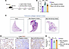 Inhibition of miR-205-5p mitigates fibrosis progression in aged mice challe