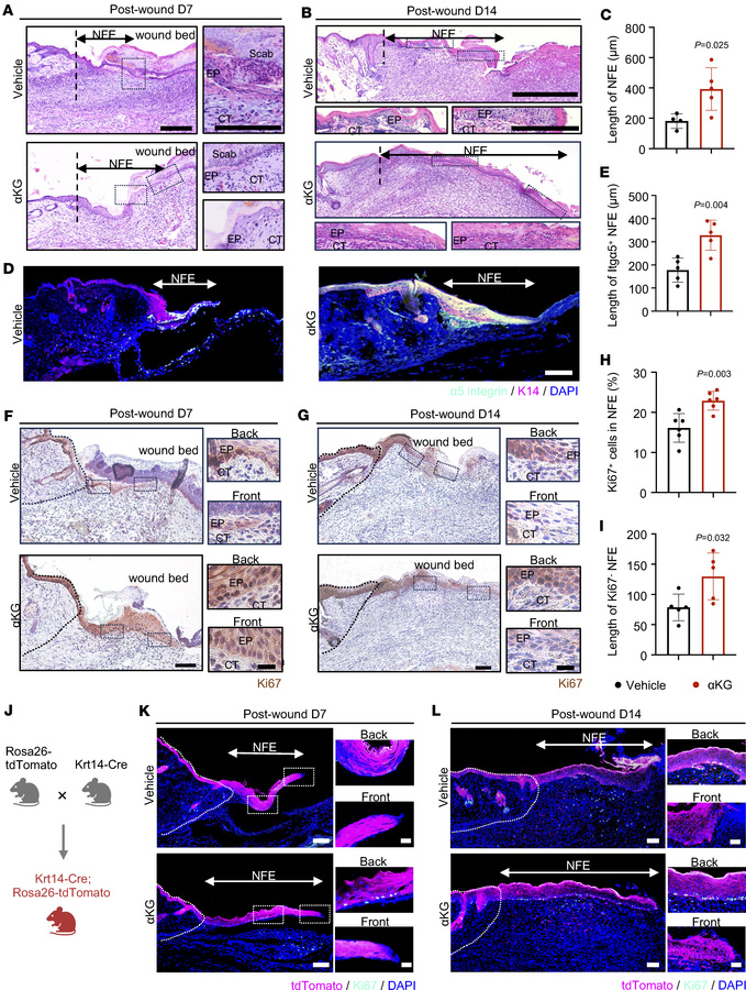 αKG improves re-epithelialization with extended epithelial tongue.
(A an...
