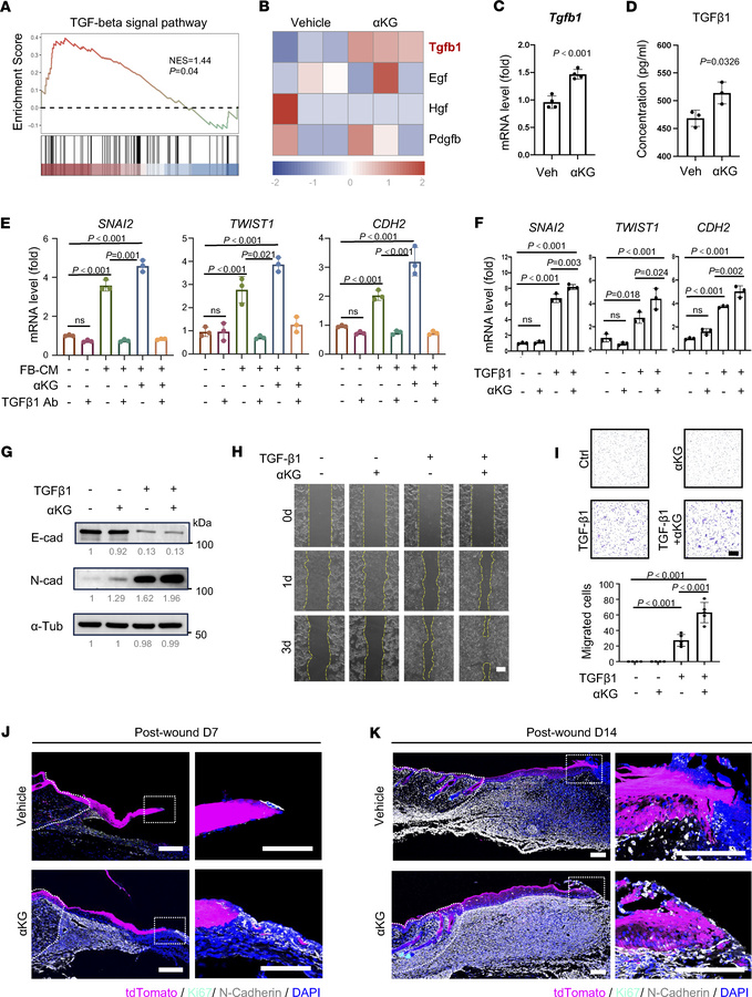 αKG promotes epithelial migration through the EMT program.
(A) GSEA of T...