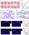 αKG promotes cutaneous wound healing.