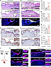 αKG improves re-epithelialization with extended epithelial tongue.