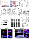 αKG promotes epithelial migration through the EMT program.
