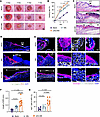 αKG-MN promotes wound closure and re-epithelialization in acute skin wounds