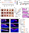 αKG-MN rescues impaired healing in diabetic wounds.