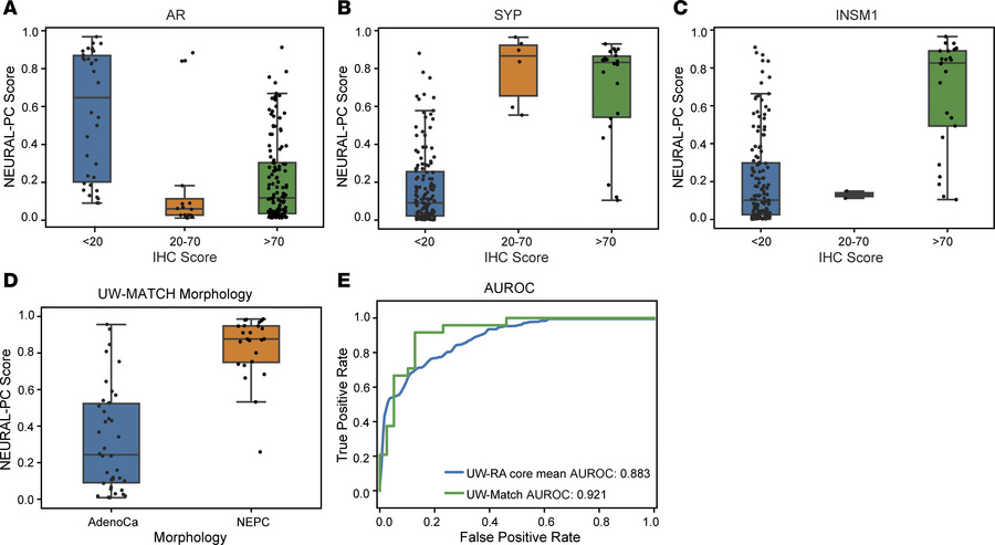 Model performances on internal and external validation cohorts.
(A–C) NE...