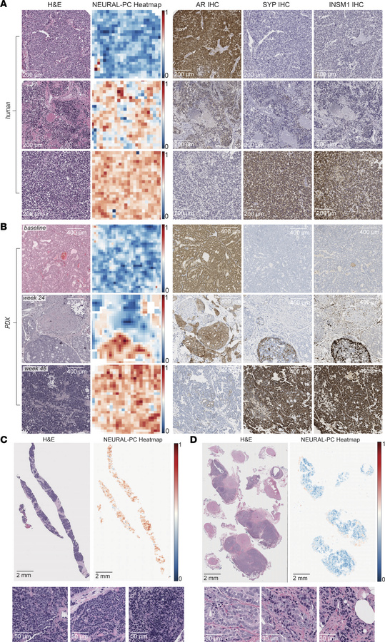 Representative visual NEURAL-PC predictions and spatial IHC association....