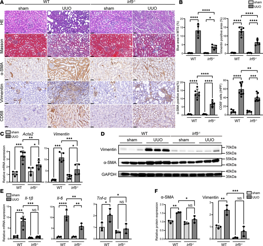 IRF5 KO mitigates inflammation and fibrosis in the UUO mouse model.
(A) ...