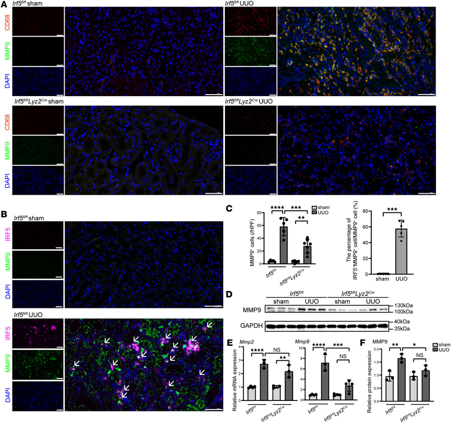 The regulatory effect of IRF5 on MMP9 expression in vivo.
(A) Representa...