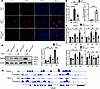 IRF5 positively regulates MMP9 expression and inflammation in BMDMs.