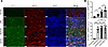 MMP9 expression was significantly elevated and colacalized with IRF5 in pat