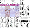 IRF5 inhibitors mitigated renal fibrosis in vivo.