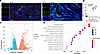 IRF5+CD68+ cell expression markedly increases in UUO mouse renal tissues.