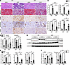 IRF5 KO mitigates inflammation and fibrosis in the UUO mouse model.