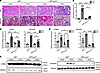 IRF5 deficiency in myeloid cells inhibits renal fibrosis in vivo.