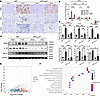 IRF5 deficiency in myeloid cells reduces renal inflammation in vivo.