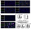 The regulatory effect of IRF5 on MMP9 expression in vivo.