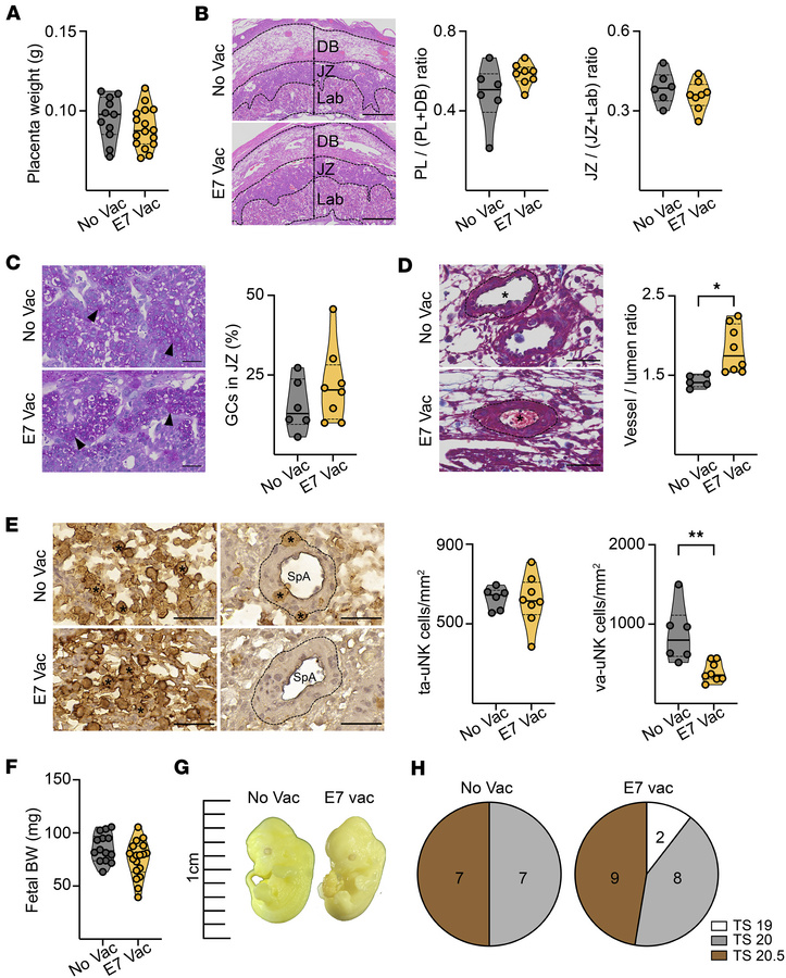 VSV-EBOV vaccination in pregnant dams affects placental morphology but d...