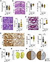 VSV-EBOV vaccination in pregnant dams affects placental morphology but does