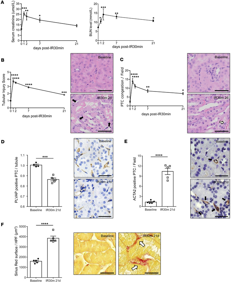 Renal IRI induces kidney dysfunction, tubular damage, microvascular rare...