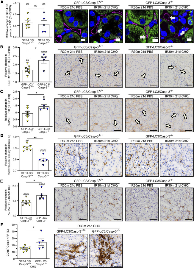 Autophagy disruption and caspase-3 deficiency worsen microvascular raref...