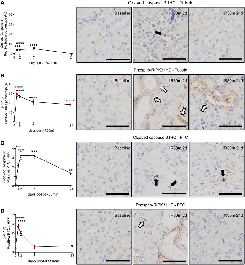 Renal IRI induces unique patterns of caspase-3–dependent apoptosis and n...