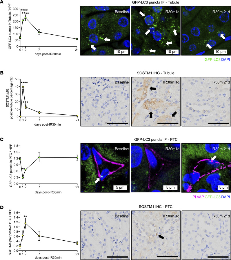 Renal IRI induces autophagy in tubules and peritubular capillaries (PTCs...