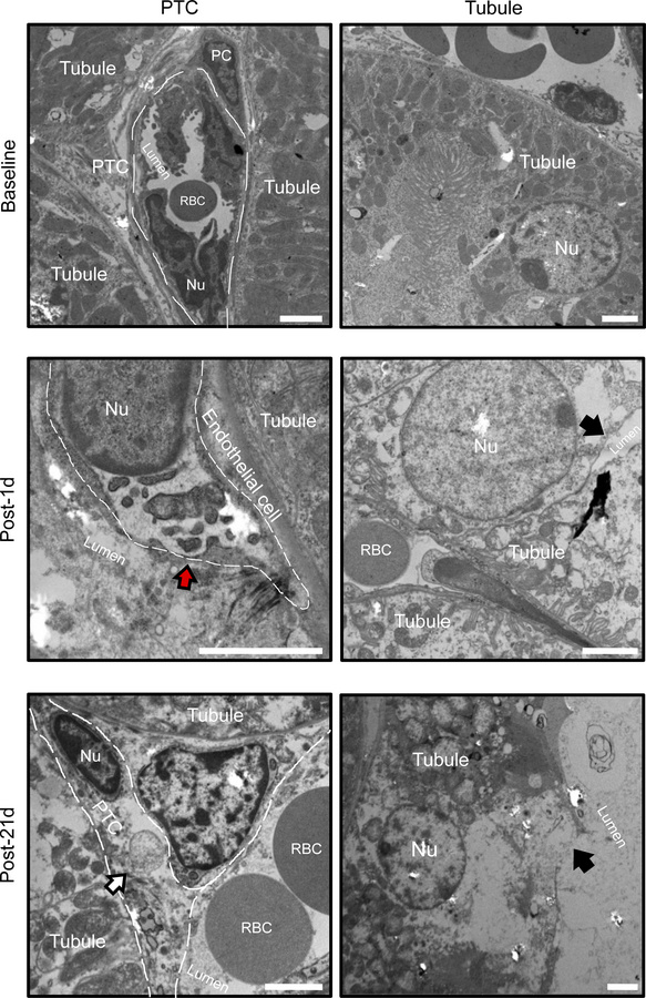 Caspase-3–dependent apoptosis, necroptosis, and autophagy in renal tubul...