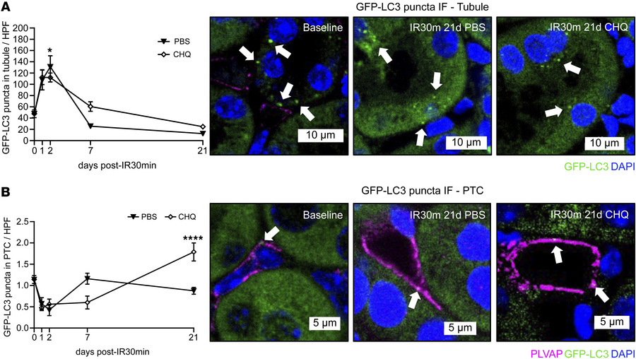 Chloroquine (CHQ) inhibits autophagy following renal IRI.
(A) Quantifica...