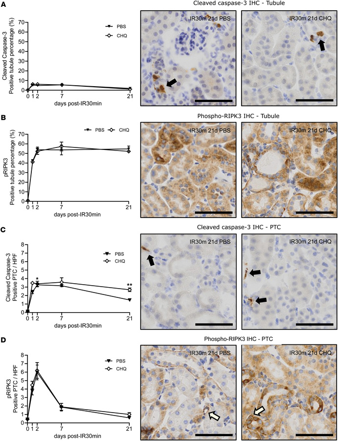 Autophagy disruption enhances apoptosis of peritubular capillaries (PTCs...