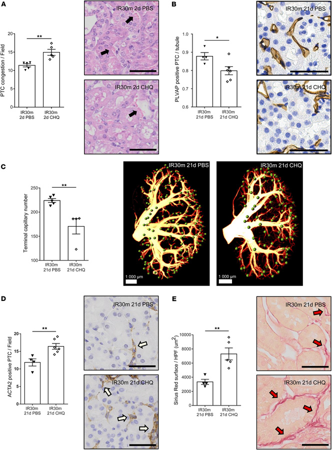 Autophagy disruption aggravates microvascular rarefaction and fibrosis f...