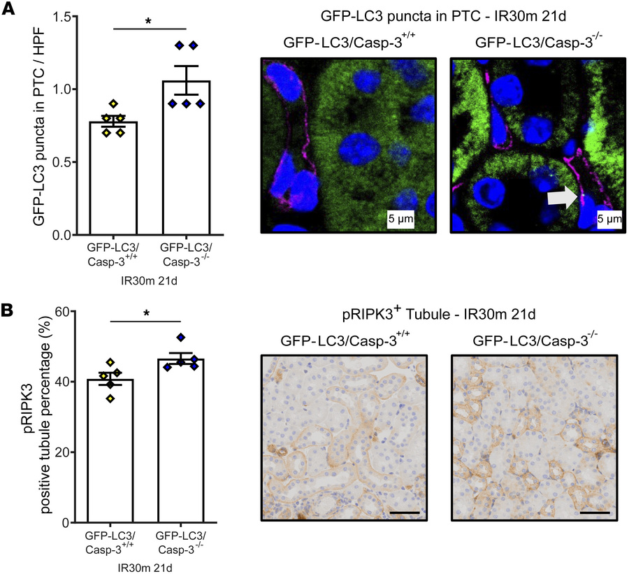 Concomitant autophagy disruption and caspase-3 deficiency enhance necrop...