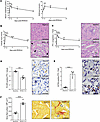 Renal IRI induces kidney dysfunction, tubular damage, microvascular rarefac