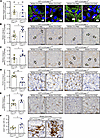 Autophagy disruption and caspase-3 deficiency worsen microvascular rarefact